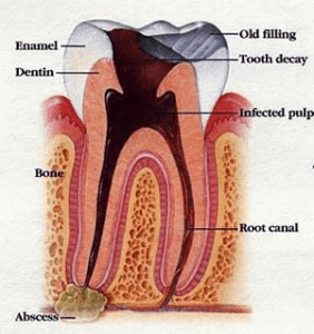 Read more about the article Granuloma